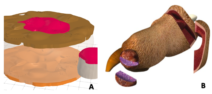 Usos del modelado 3D en técnicas quirúrgicas