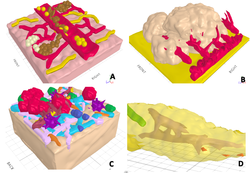 Uso del modelado 3D en medicina