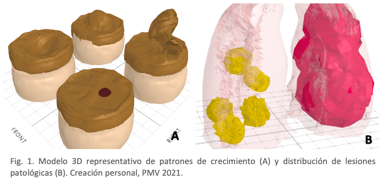 Modelado 3D en patología