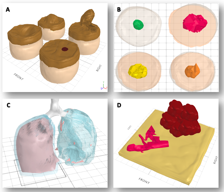 Varios modelos animados en 3D que se han aplicado en temas de patología y técnica quirúrgica.