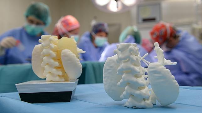 Impresión 3D en medicina